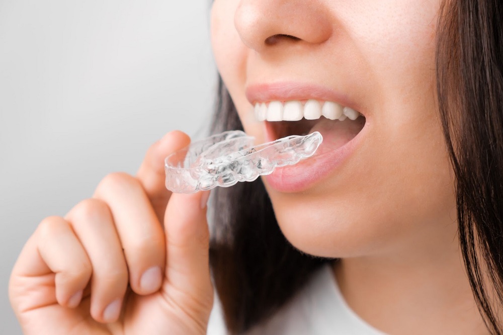 Can You Wear Your Retainer If It Feels Too Tight?
