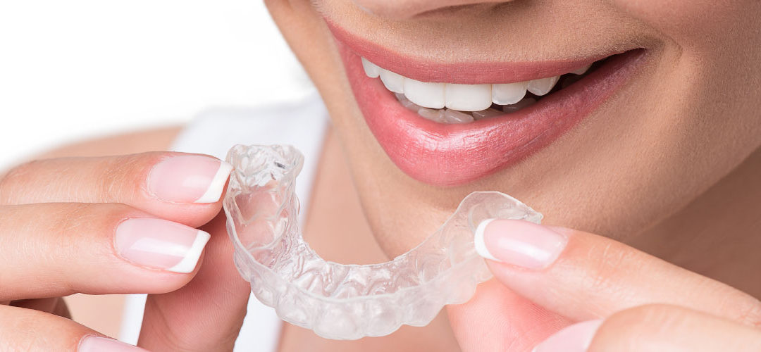 How to Keep Your Invisalign Aligners Clean