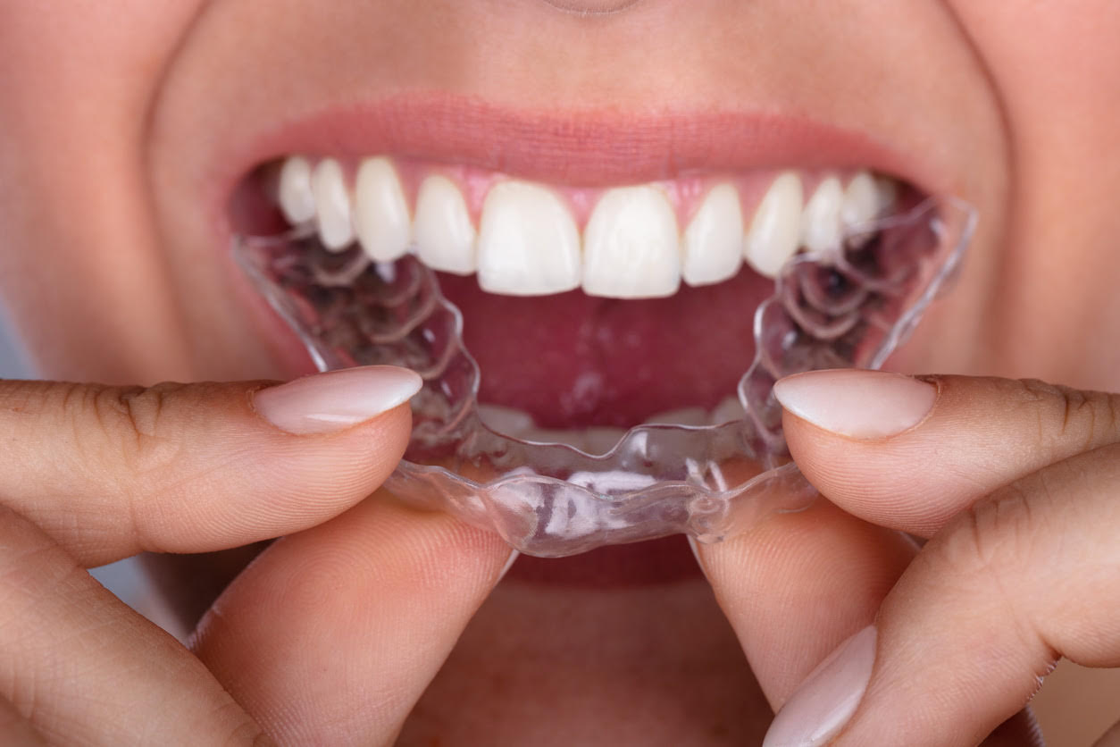 Tips to Making Your Invisalign Experience Fast & Effective